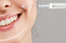Tiêm Rãnh Cười Bao Lâu Thì Đẹp? Có Biến Chứng Tiêm Filler Rãnh Cười Không?