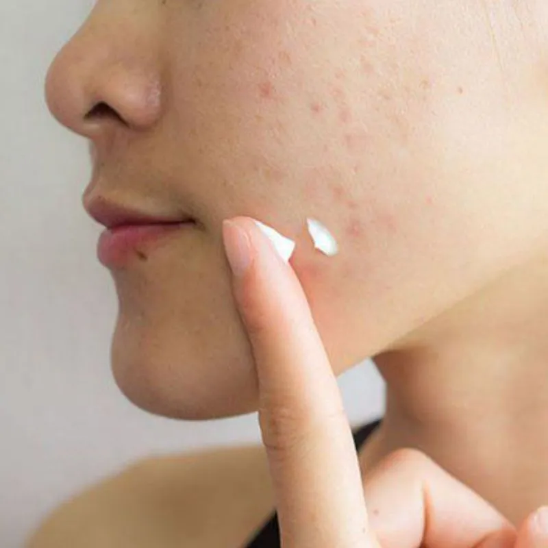 Dưỡng ấm giúp làn da căng tràn, khỏe mạnh