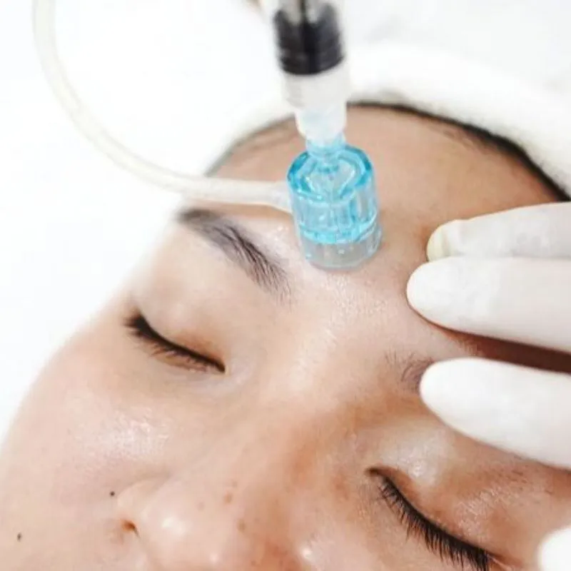 Chi phí cấy collagen có nhiều mức giá khác nhau