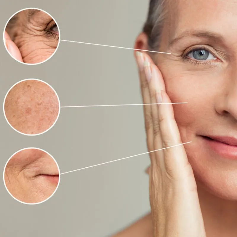 Tìm hiểu về lão hóa da