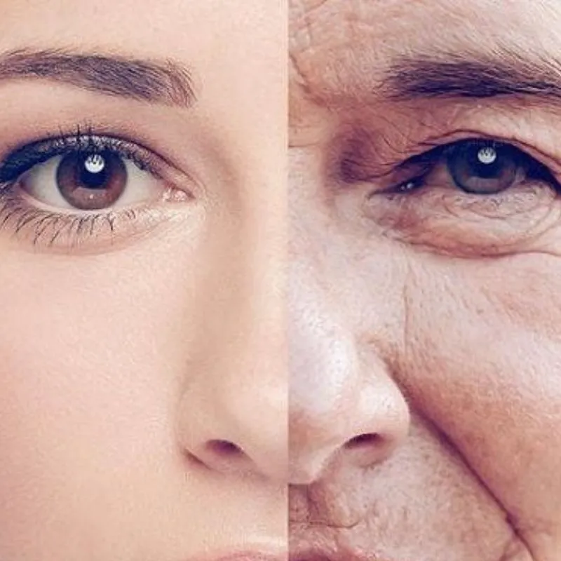 Da mặt chảy xệ là dấu hiệu có thể dễ thấy nhất