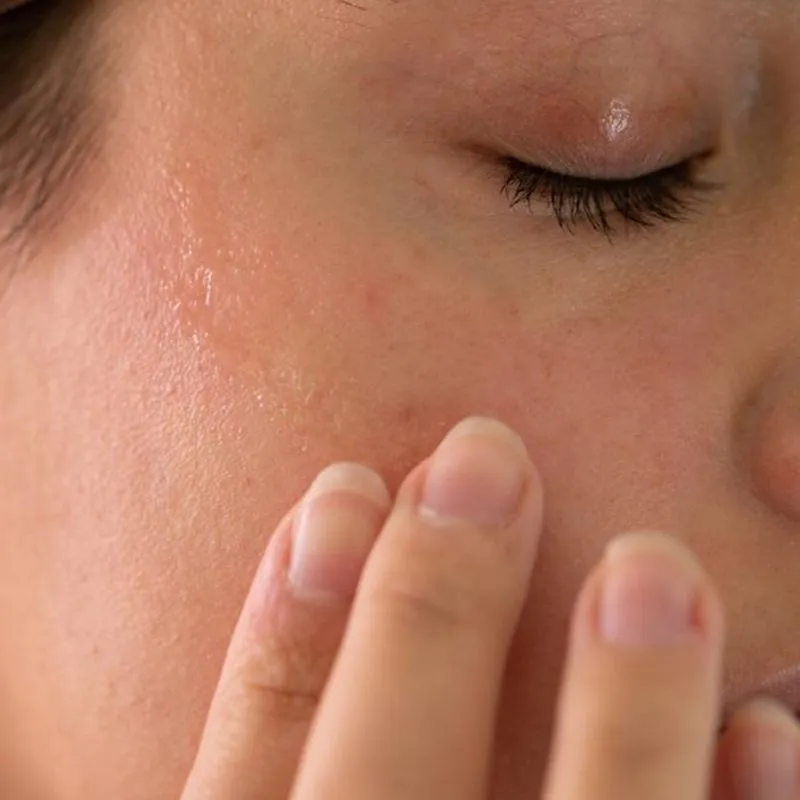 Thâm nám và tàn nhang tăng lên