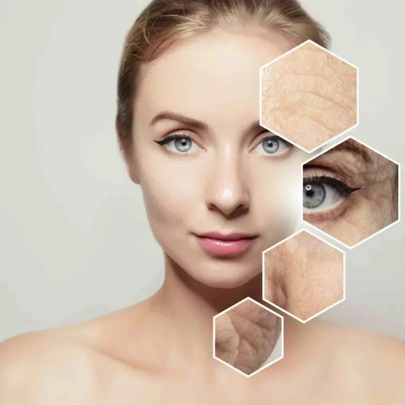 Lão hóa da là gì