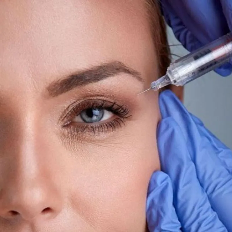 Cách tiêm botox xóa nhăn mắt