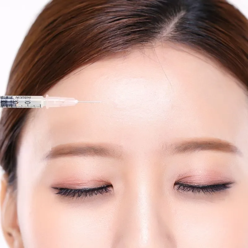 Cách tiêm botox xóa nhăn trán