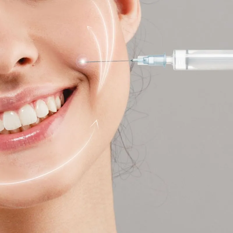 Tiêm Rãnh Cười Bao Lâu Thì Đẹp? Có Biến Chứng Không?