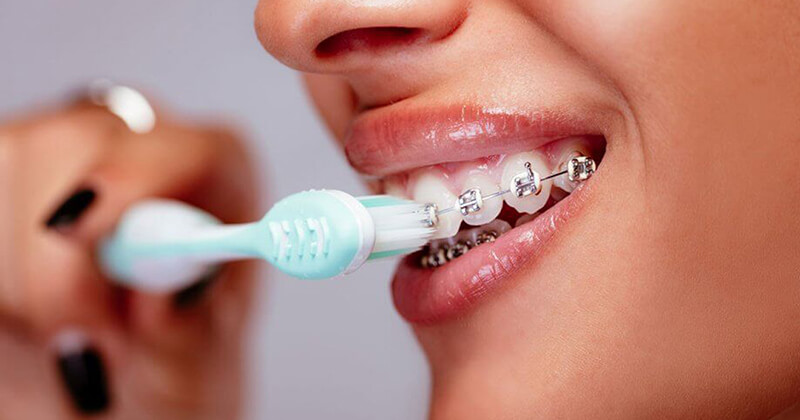 Một số lưu ý khi sử dụng bàn chải điện