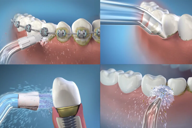 Vậy tại sao nên dùng máy tăm nước hằng ngày?